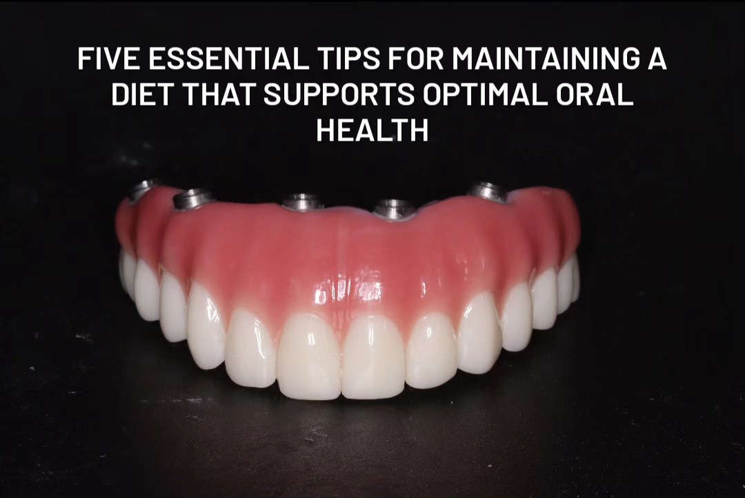 Five Essential Tips for Optimal Oral Health