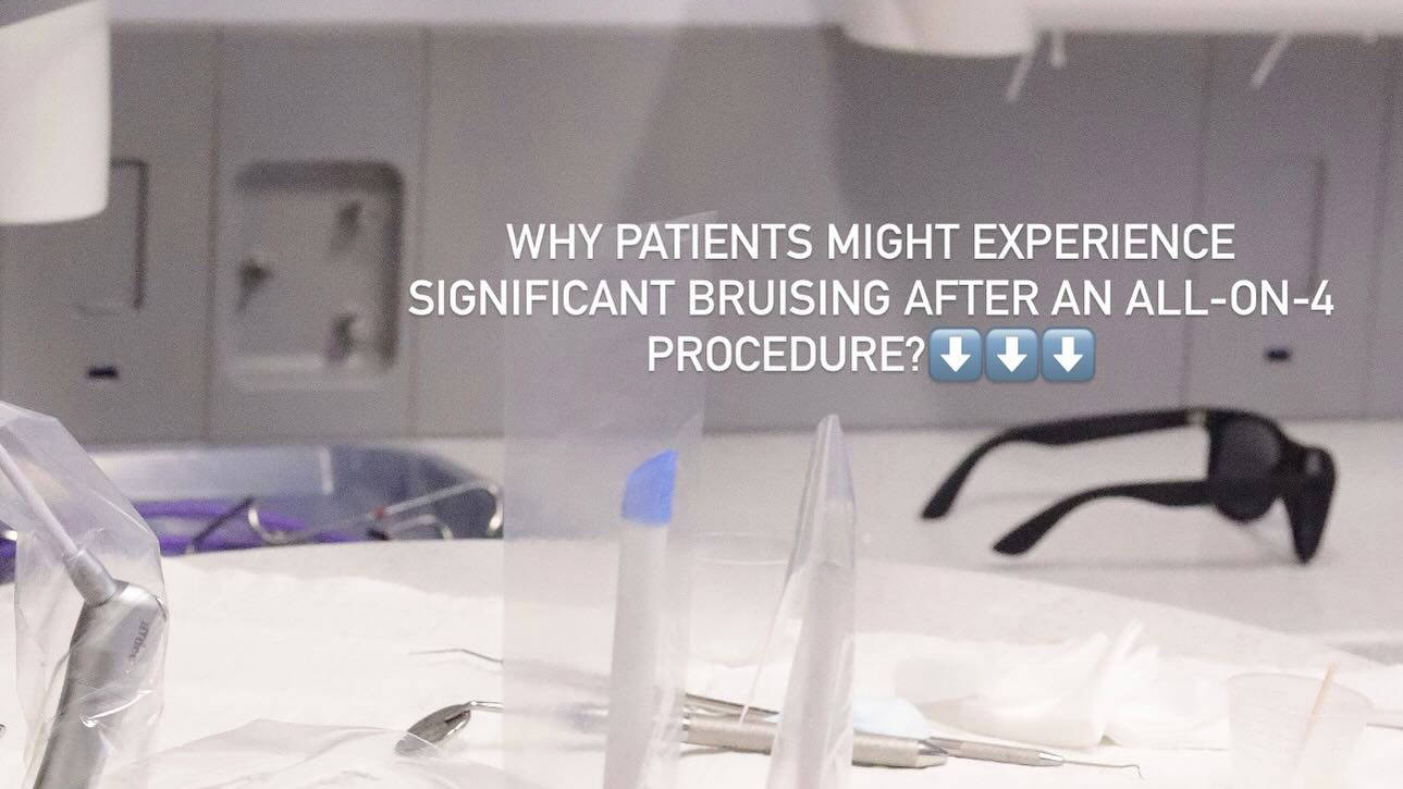 Brusing After All-on-4 Dental Implant Procedure?