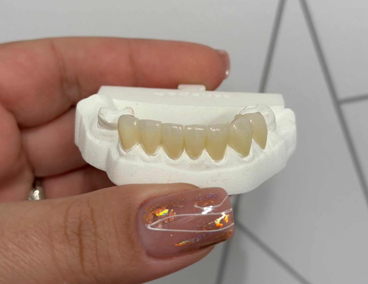 Transform Your Smile with Ideal Dental Crowns