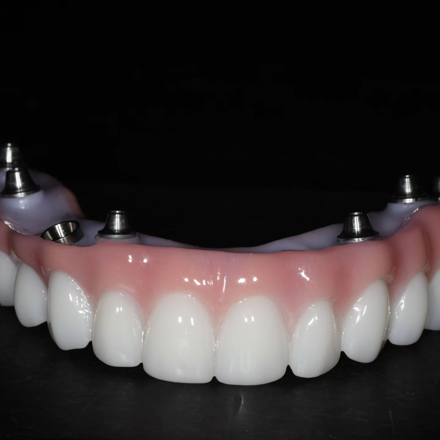 Dyal Non-removable Dentures